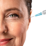 Wrinkle Relaxing - 3 Areas - Image 2